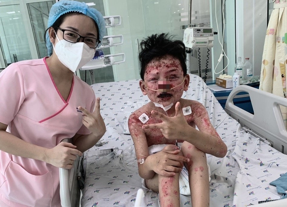 Sau 20 ngày được điều trị tích cực trong môi trường vô trùng, bệnh nhi đã qua được nguy kịch (ảnh: BVCC)