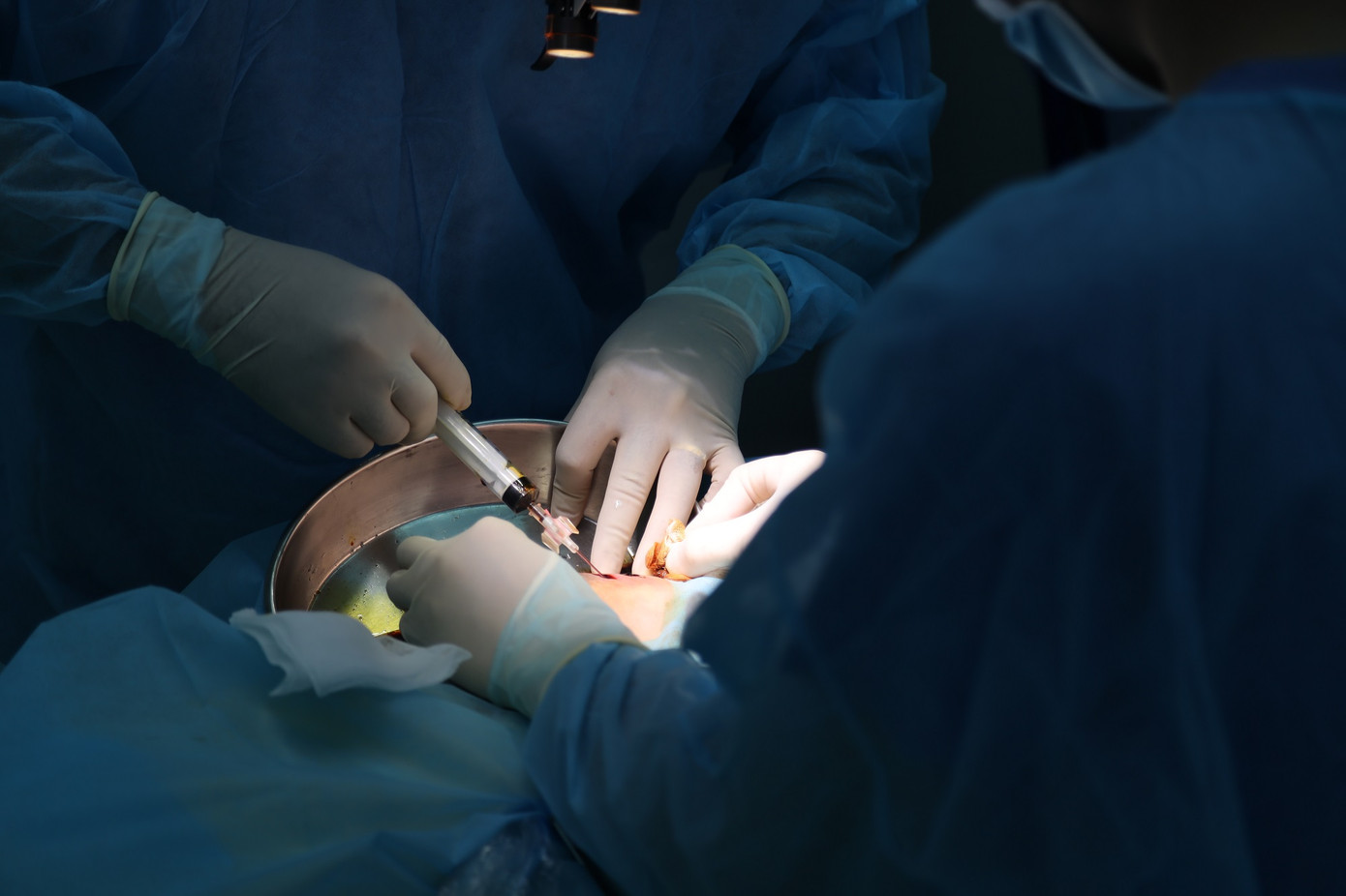 Các bác sĩ xử lý ổ nhiễm trùng trên vùng ngực của bệnh nhân bị tai biến sau tiêm filler Các bác sĩ xử lý ổ nhiễm trùng trên vùng ngực của bệnh nhân bị tai biến sau tiêm filler