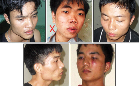  Nguyễn Văn Quý (X) cùng đồng bọn