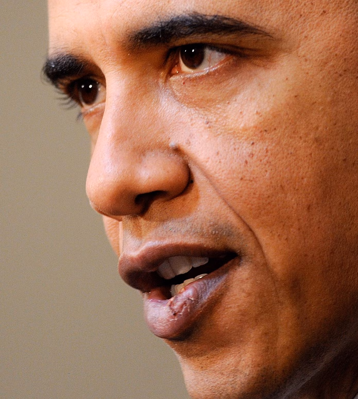 Vết thương ở môi ông Obama từng gây xôn xao dư luận một thời. Ảnh: Getty Images.