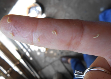 Theo bà Tư những vật thể lạ nhỏ, mềm này là con sâu răng!