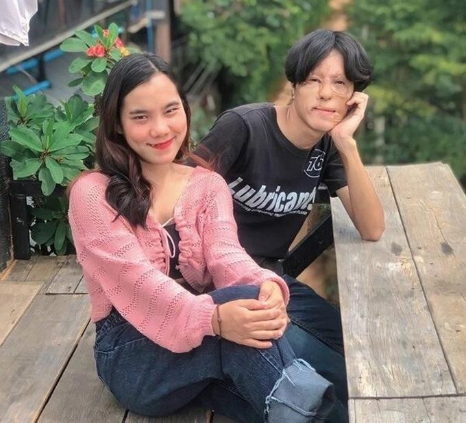 Nhờ tình yêu, chàng trai 22 tuổi không còn mặc cảm về ngoại hình như trước (Ảnh: News).