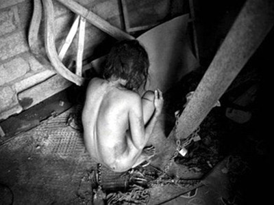 Komang - người đã bị gia đình xích lại suốt 8 năm qua