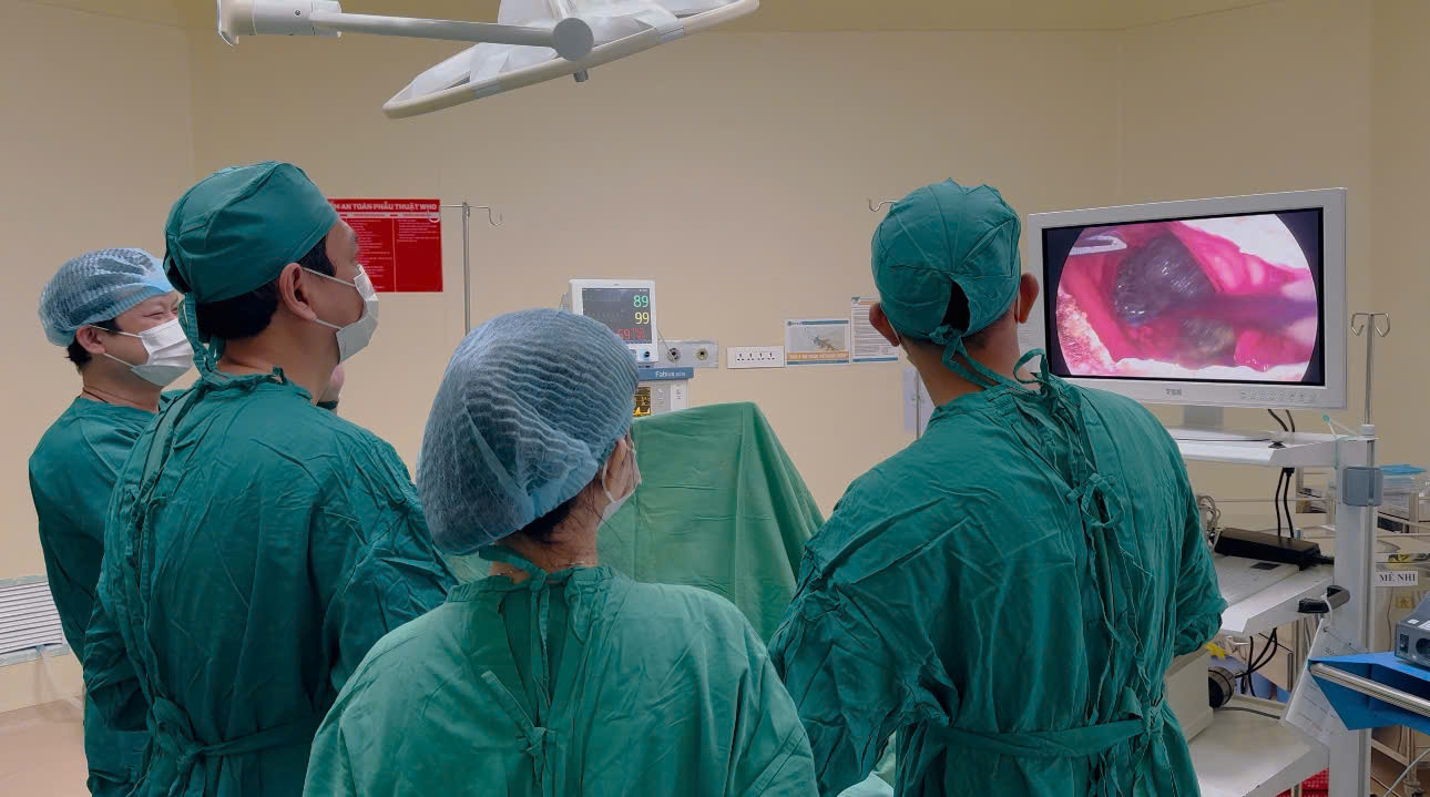 Các bác sĩ đã thực hiện cuộc phẫu thuật nội soi lấy thành công khối tóc trong dạ dày bệnh nhi