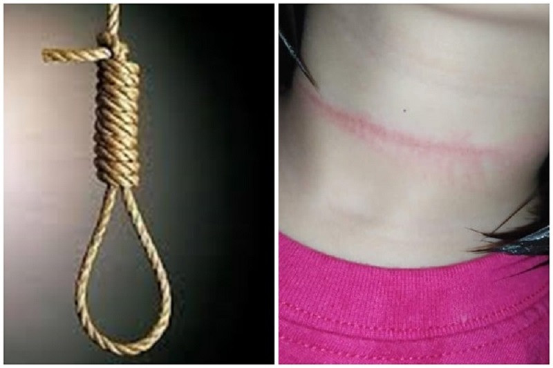 Chỉ vì chút mâu thuẫn nhỏ với chị, bé gái đã suýt mất đi sự sống quý giá của mình Chỉ vì chút mâu thuẫn nhỏ với chị, bé gái đã suýt mất đi sự sống quý giá của mình