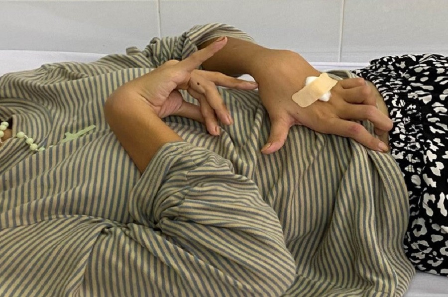 Thời điểm nhập viện điều trị, chân tay bệnh nhân co cứng, mất hoàn toàn khả năng đi lại Thời điểm nhập viện điều trị, chân tay bệnh nhân co cứng, mất hoàn toàn khả năng đi lại