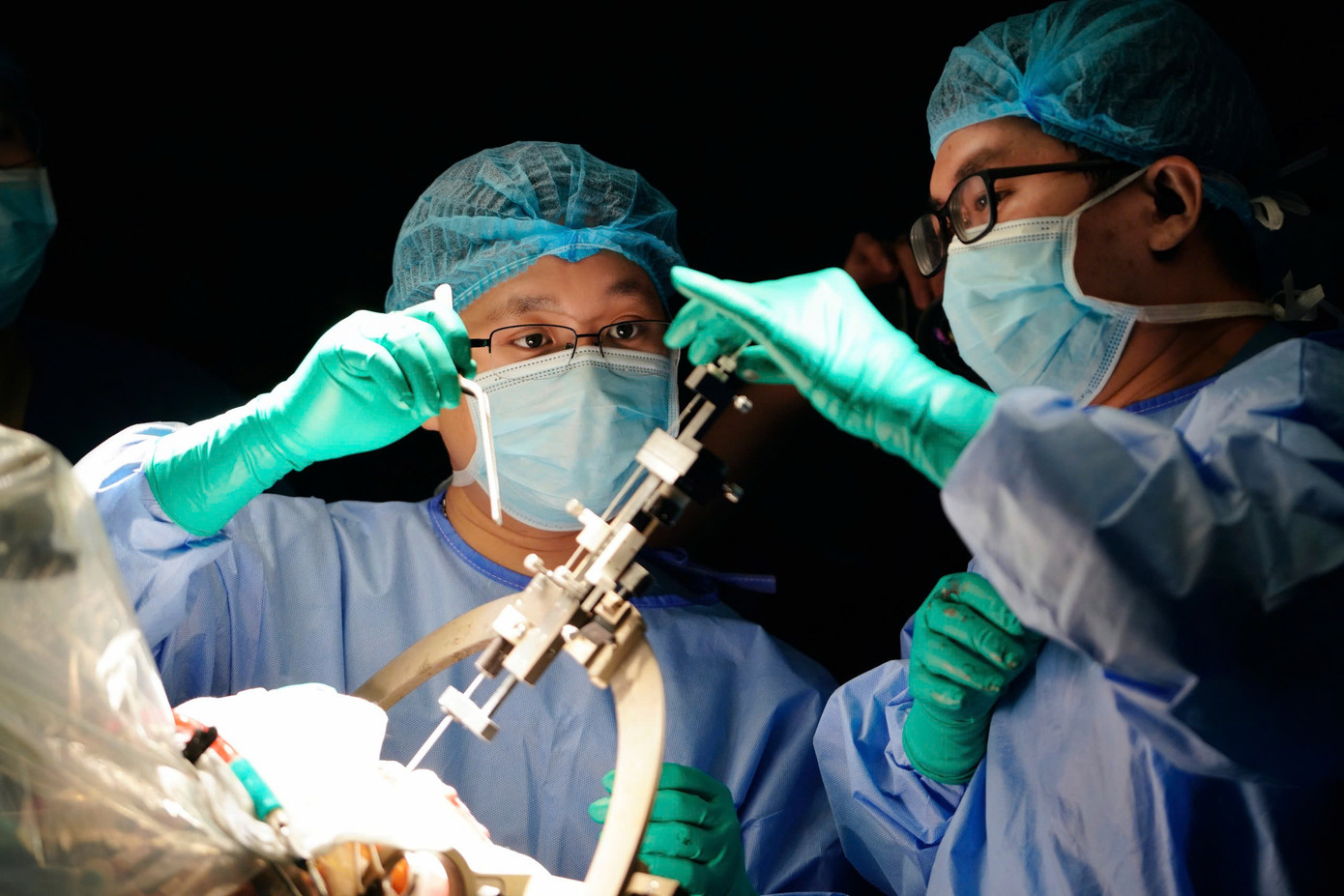 Các bác sĩ Bệnh viện Đại học Y Dược thực hiện phương pháp đặt điện cực kích thích não sâu cho cho bệnh nhân bị động kinh