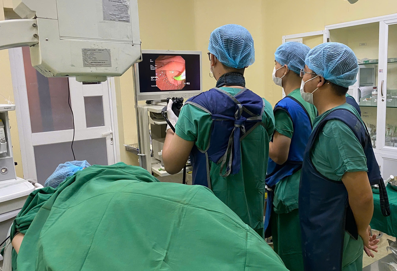 Bằng phương pháp nội soi mật tụy ngược dòng (ERCP) các bác sĩ đã bắt được con sán lớn ra khỏi cơ thể người bệnh Bằng phương pháp nội soi mật tụy ngược dòng (ERCP) các bác sĩ đã bắt được con sán lớn ra khỏi cơ thể người bệnh