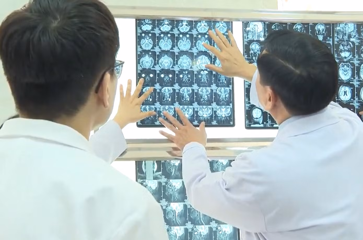 Các bác sĩ hội chẩn tìm giải pháp điều trị tối ưu để cứu thị lực cho người bệnh