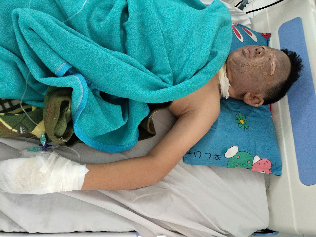 Tai nạn pháo nổ thường xảy ra vào cuối năm, phụ huynh cần cảnh báo và giáo dục con trẻ tránh nguy hiểm Tai nạn pháo nổ thường xảy ra vào cuối năm, phụ huynh cần cảnh báo và giáo dục con trẻ tránh nguy hiểm