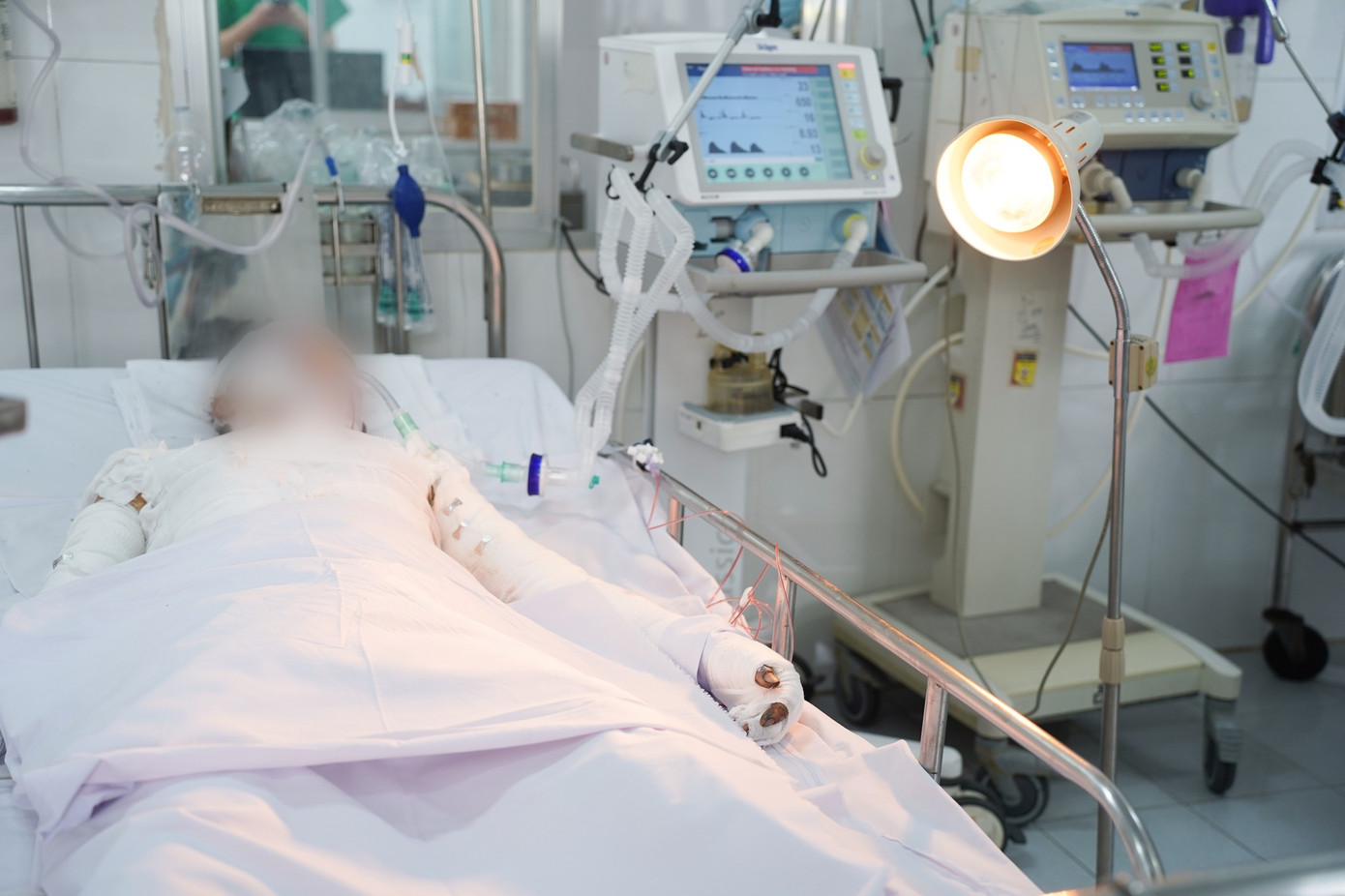 Chỉ trong thời gian ngắn, Bệnh viện Chợ Rẫy đã tiếp nhận 6 trường hợp bị tai nạn pháo tự chế