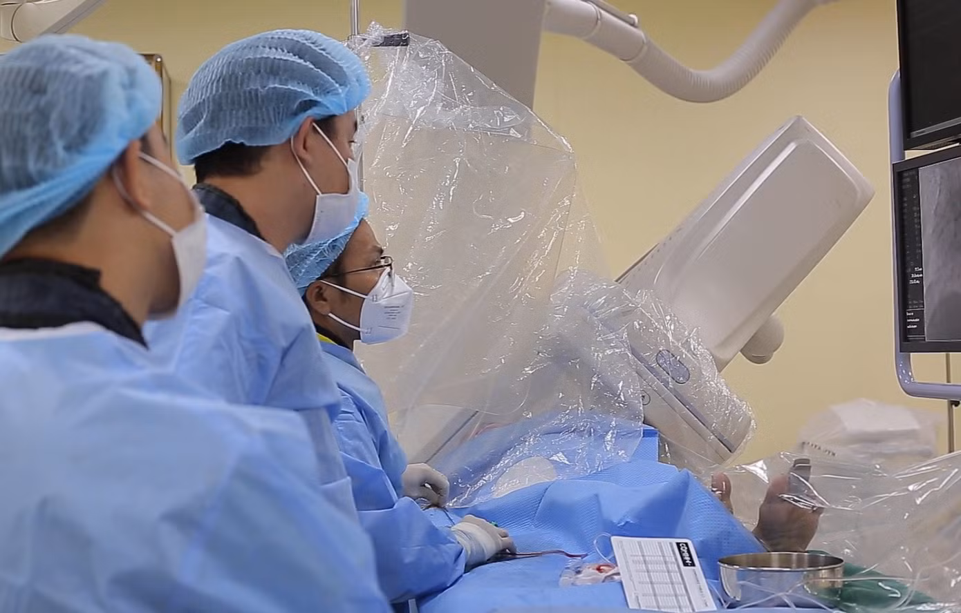 Các bác sĩ can thiệp nội mạch lấy huyết khối trong động mạch não giữa cho bệnh nhân