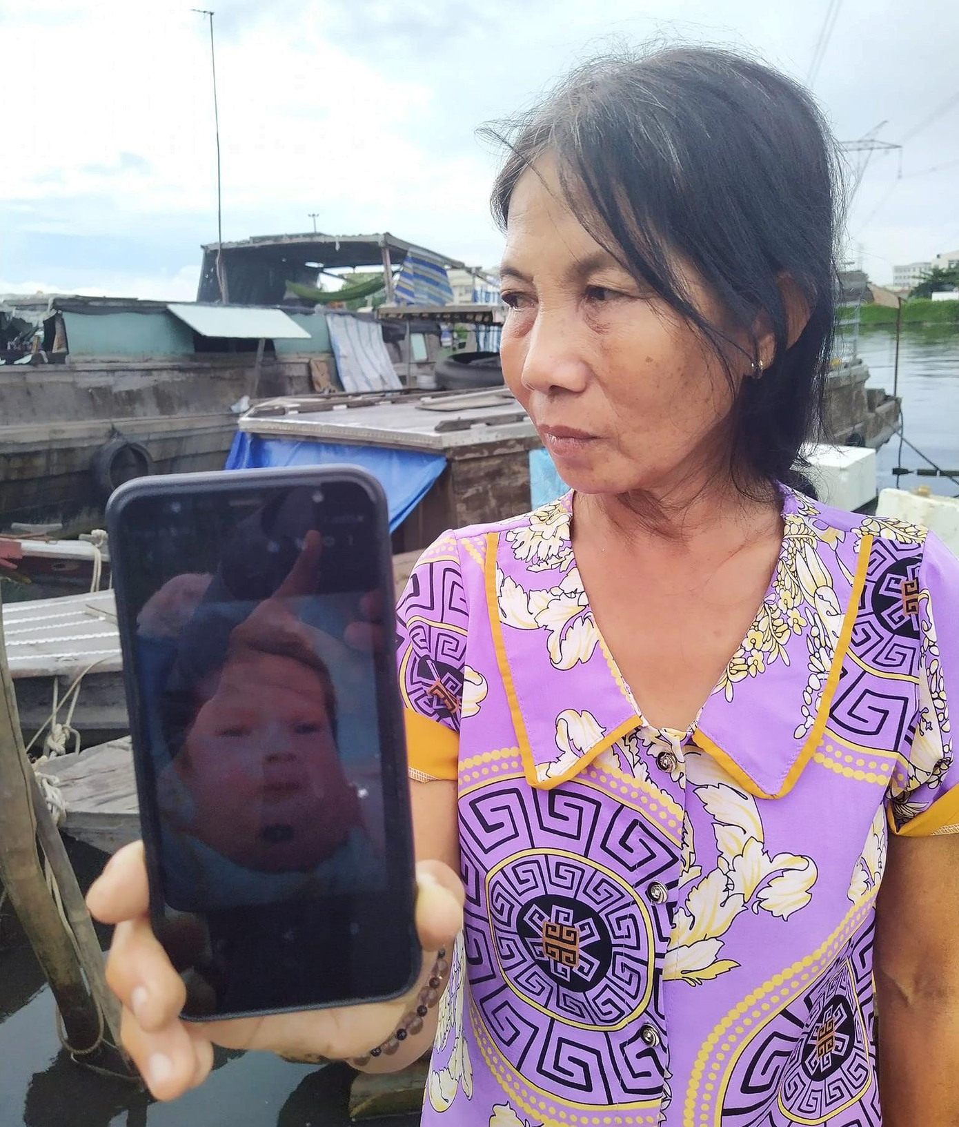 Chị Mai với hình ảnh chụp đứa cháu bị bướu cổ không có thuốc uống