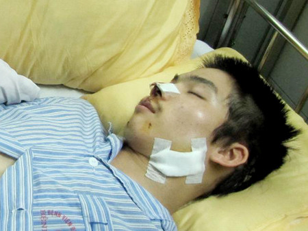 Nạn nhân đang được điều trị tại bệnh viện