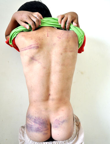 Bé trai Trần Tự (9 tuổi) bị cha đánh đập tàn bạo