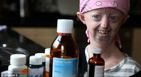 Hayley Okines đã tìm hiểu rất nhiều về căn bệnh của mình