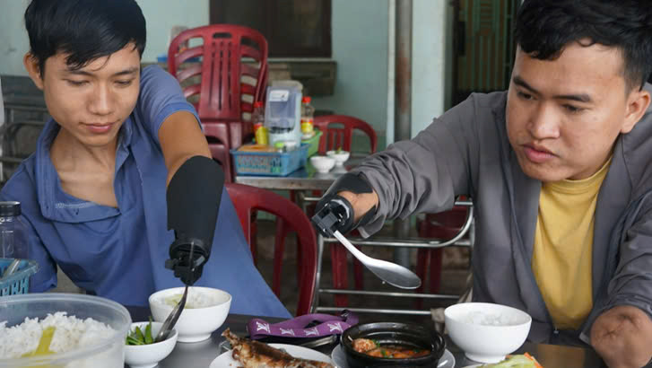 Bộ khớp được trao tặng đến những người khuyết tật trong chuyến đi Nha Trang của nhóm 4D. Ảnh: NVCC Bộ khớp được trao tặng đến những người khuyết tật trong chuyến đi Nha Trang của nhóm 4D. Ảnh: NVCC