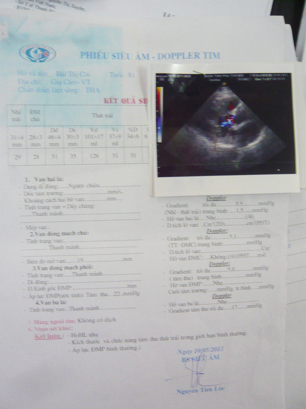 Hồ sơ bệnh án của bệnh nhân Bùi Thị Côi cho thấy, BVĐK Phú Thọ đã ép bệnh nhân sử dụng quá nhiều DVKT đắt tiền Ảnh: Phong Cầm