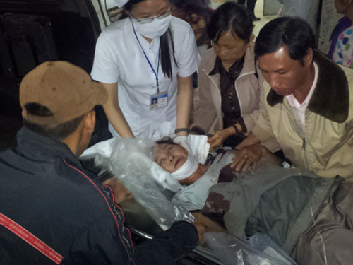 Bà Nga bị chấn thương nặng vùng đầu