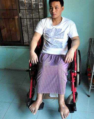 Ngư dân trẻ Nguyễn Vui bị liệt nửa người do lặn bắt hải sâm dưới biển sâu quá lâu . Ảnh: Trí Tín. Ngư dân trẻ Nguyễn Vui bị liệt nửa người do lặn bắt hải sâm dưới biển sâu quá lâu . Ảnh: Trí Tín