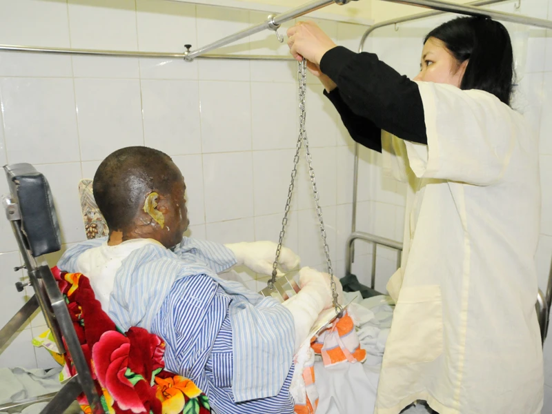 Đỗ Ngọc Mạnh (38 tuổi) bị bỏng lửa 24%, bỏng sâu 7%, bỏng hô hấp. Ảnh: Tuấn Nguyễn