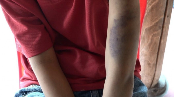 Trốn học đi đá bóng, nam sinh lớp 8 bị bố cùng mẹ kế đánh dã man ảnh 3