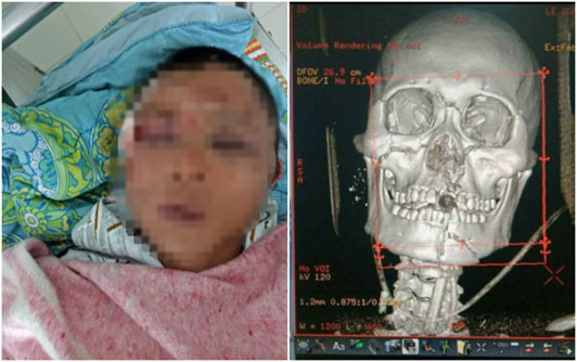 Bị đánh oan, người đàn ông nát mặt, tổn thương toàn bộ nội tạng ảnh 1