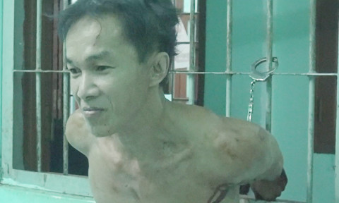 Bắt nghi phạm giết người dã man, Trung tá công an bị chém gục ảnh 1