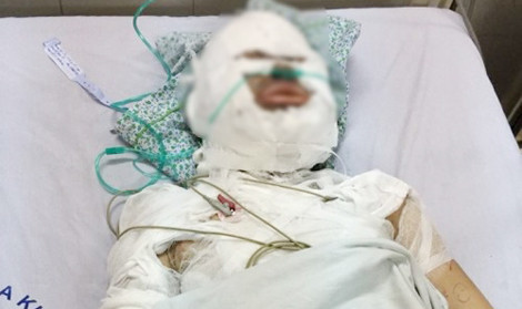 Mới nhất vụ người phụ nữ bị gã đàn ông ngoại quốc thiêu sống ảnh 1