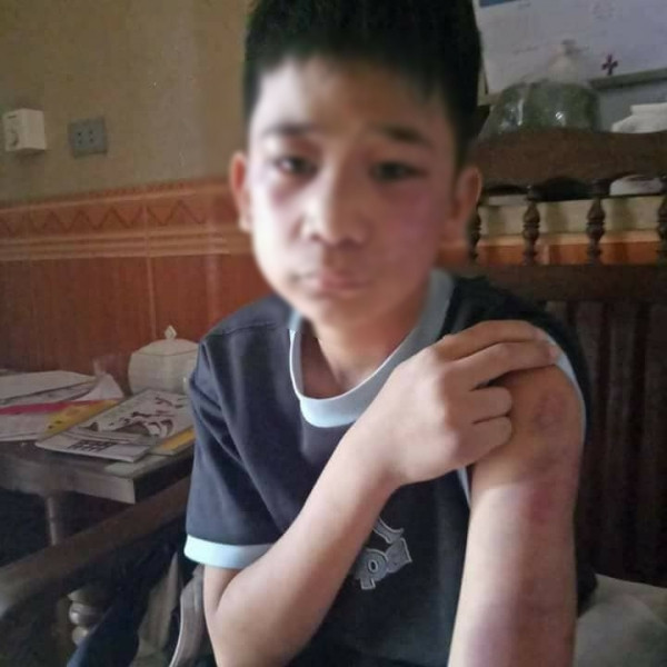 Trốn học đi đá bóng, nam sinh lớp 8 bị bố cùng mẹ kế đánh dã man ảnh 1