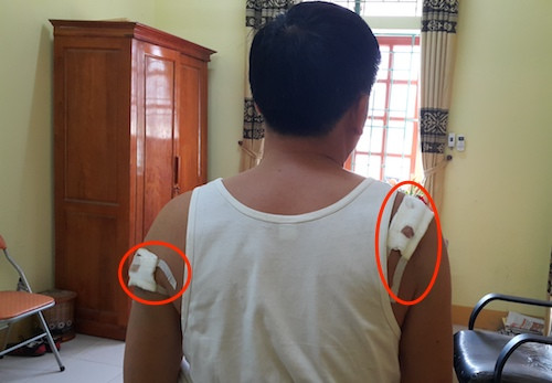 Khởi tố trưởng công an nã đạn vào chủ tịch xã ảnh 1