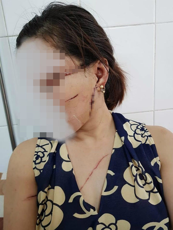 Rạch mặt, cắt gân chân vợ sau chuyến xuất khẩu lao động ảnh 1