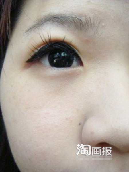 Mắt khi nhìn lên