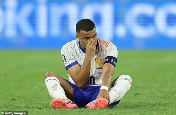 Mbappe ôm mũi quay lại ngồi trên sân để trận đấu chưa tiếp tục được. Ảnh: Getty.