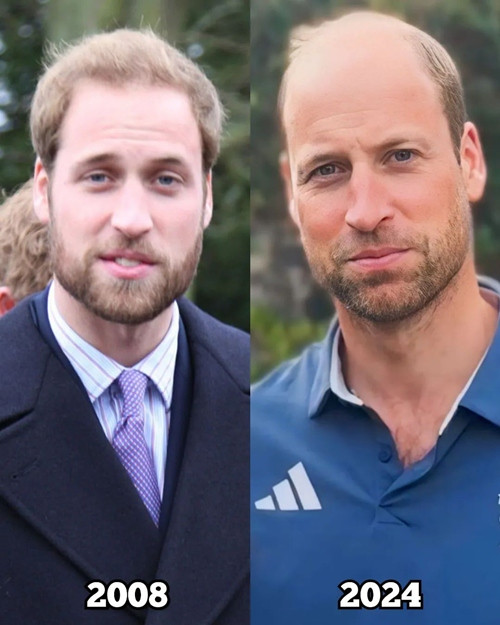 Hoàng tử William năm 2008 và 2024. Ảnh: Instagram. Hoàng tử William năm 2008 và 2024. Ảnh: Instagram.