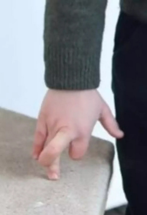 Một số người thấy bàn tay của Hoàng tử Louis trong ảnh trông cũng khá lạ. Ảnh: Kensington Royal.