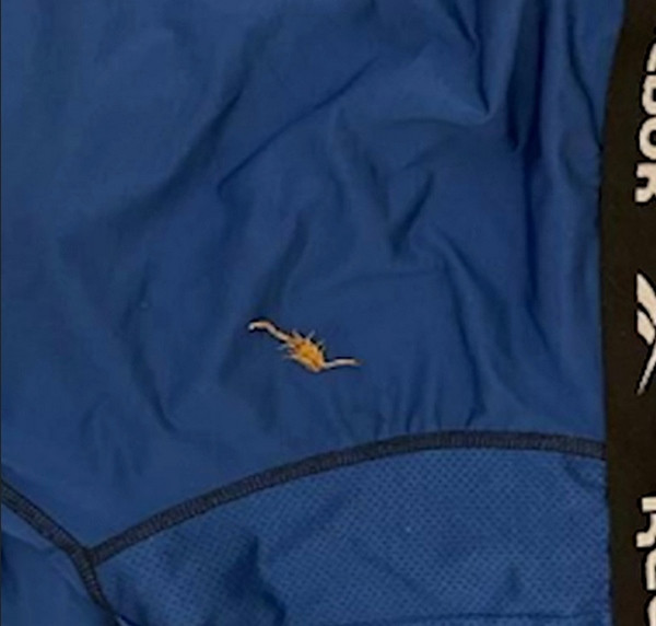 Anh Michael nhìn thấy con vật này trên chiếc quần của mình. Ảnh: Michael Farchi. Anh Michael nhìn thấy con vật này trên chiếc quần của mình. Ảnh: Michael Farchi.