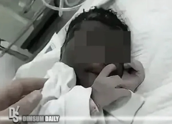 Da em bé có màu tối sẫm. Ảnh: Dimsum Daily. Da em bé có màu tối sẫm. Ảnh: Dimsum Daily.