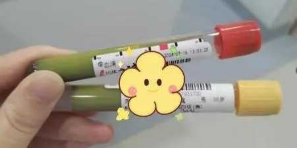 Đến bác sĩ cũng thấy khó tin rằng dung dịch màu xanh lá này là mẫu máu của bệnh nhân. Ảnh: CTWant.