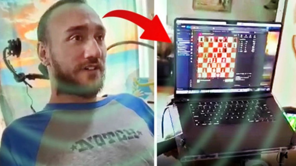 Với con chip được cấy vào não, anh Arbaugh có thể chơi cờ trên máy tính chỉ bằng ý nghĩ. Ảnh: Neuralink. Với con chip được cấy vào não, anh Arbaugh có thể chơi cờ trên máy tính chỉ bằng ý nghĩ. Ảnh: Neuralink.