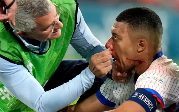Mbappe được đội ngũ y tế chăm sóc. Ảnh: AP.