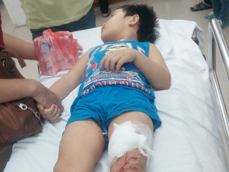 Một trong số 6 học sinh đang cấp cứu tại BV Việt Đức