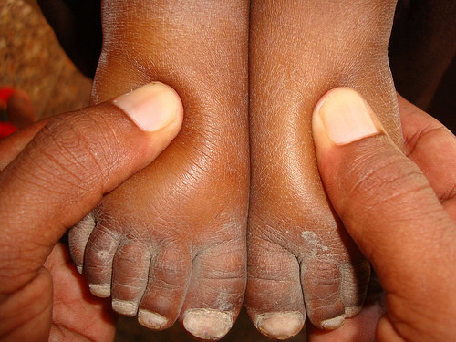 Ăn muối thế nào là tốt nhất cho sức khỏe? ảnh 1