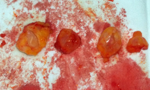 Các khối silicon sau khi được lấy ra. Ảnh: BVCC.