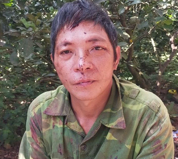 Đối tươngj Triệu Chòi Suẩn.