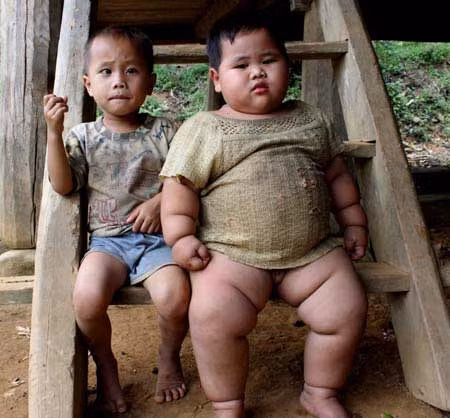 Bé Xa Tiến Thể, anh trai cậu bé khổng lồ (5 tuổi) mới nặng 12 kg. Nhưng cậu em trai Xa Hồng Anh, kém anh 3 tuổi, sinh cuối năm 2010, thì đã nặng gấp 2,5 lần anh trai