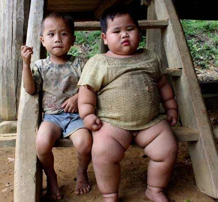 Bé Xa Tiến Thể, anh trai cậu bé khổng lồ (5 tuổi) mới nặng 12 kg. Nhưng cậu em trai Xa Hồng Anh, kém anh 3 tuổi, sinh cuối năm 2010, thì đã nặng gấp 2,5 lần anh trai