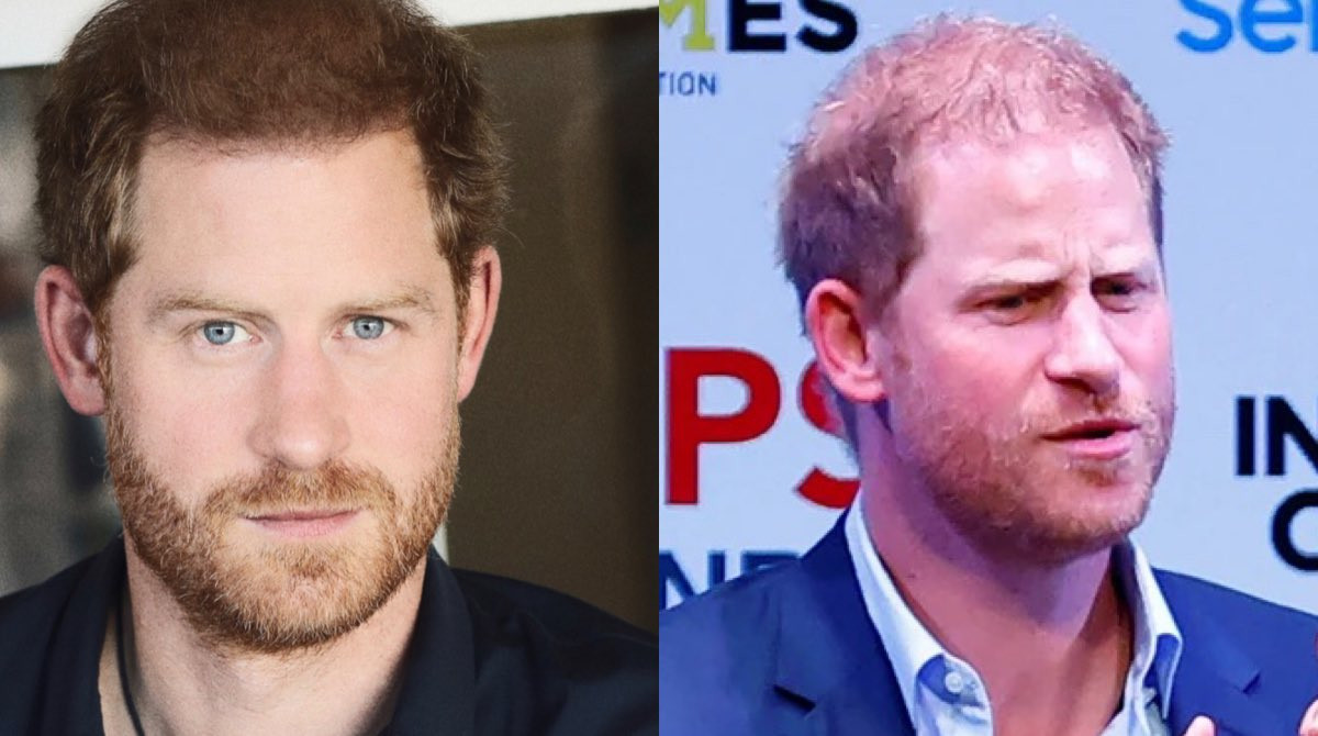 Harry bị chê cười vì bức ảnh photoshop cho mái tóc dày và sẫm màu hơn. Ảnh: Twitter.