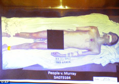 Bức ảnh thi thể khỏa thân gây sốc của ông vua nhạc pop được tòa công bố trong phiên xử bác sĩ Conrad Murray