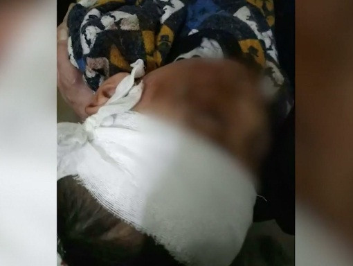 Cãi nhau với chồng cũ, mẹ ném con ra khỏi cửa sổ tầng 4 ảnh 1